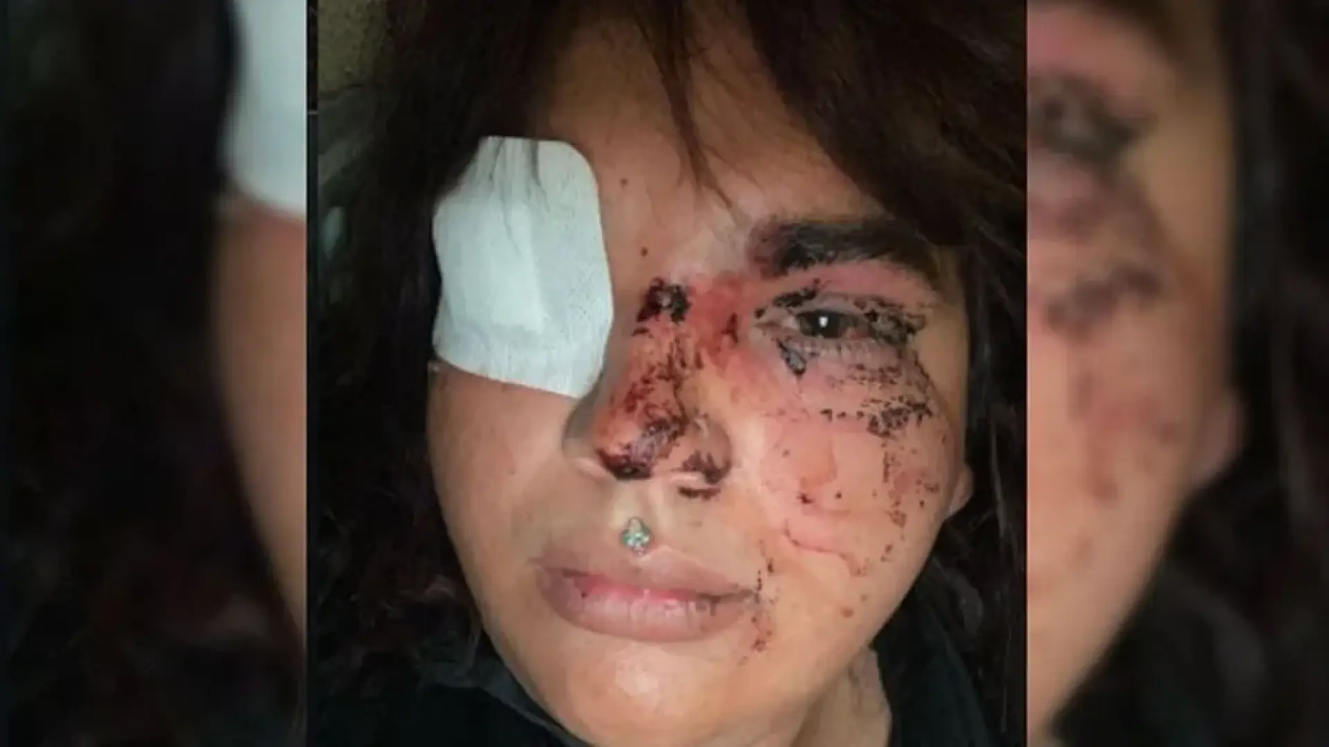 El motivo por el que se desencadenó la brutal agresión contra la mujer transexual en La Bañeza (León)