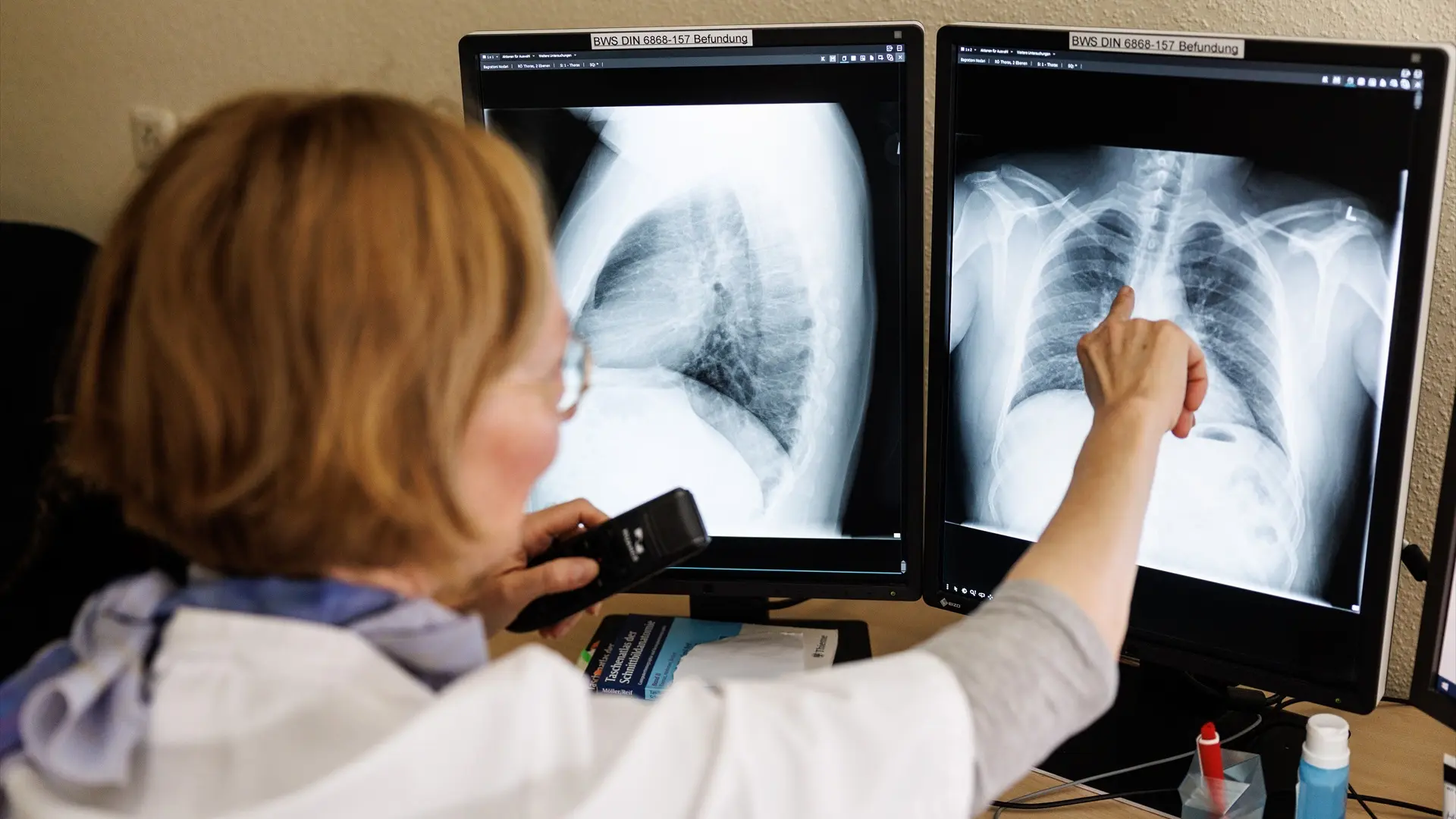 Confirman dos casos de tuberculosis en trabajadores de una explotación en Segovia: uno de los afectados ha fallecido